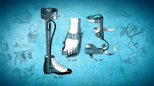 Orthopedics